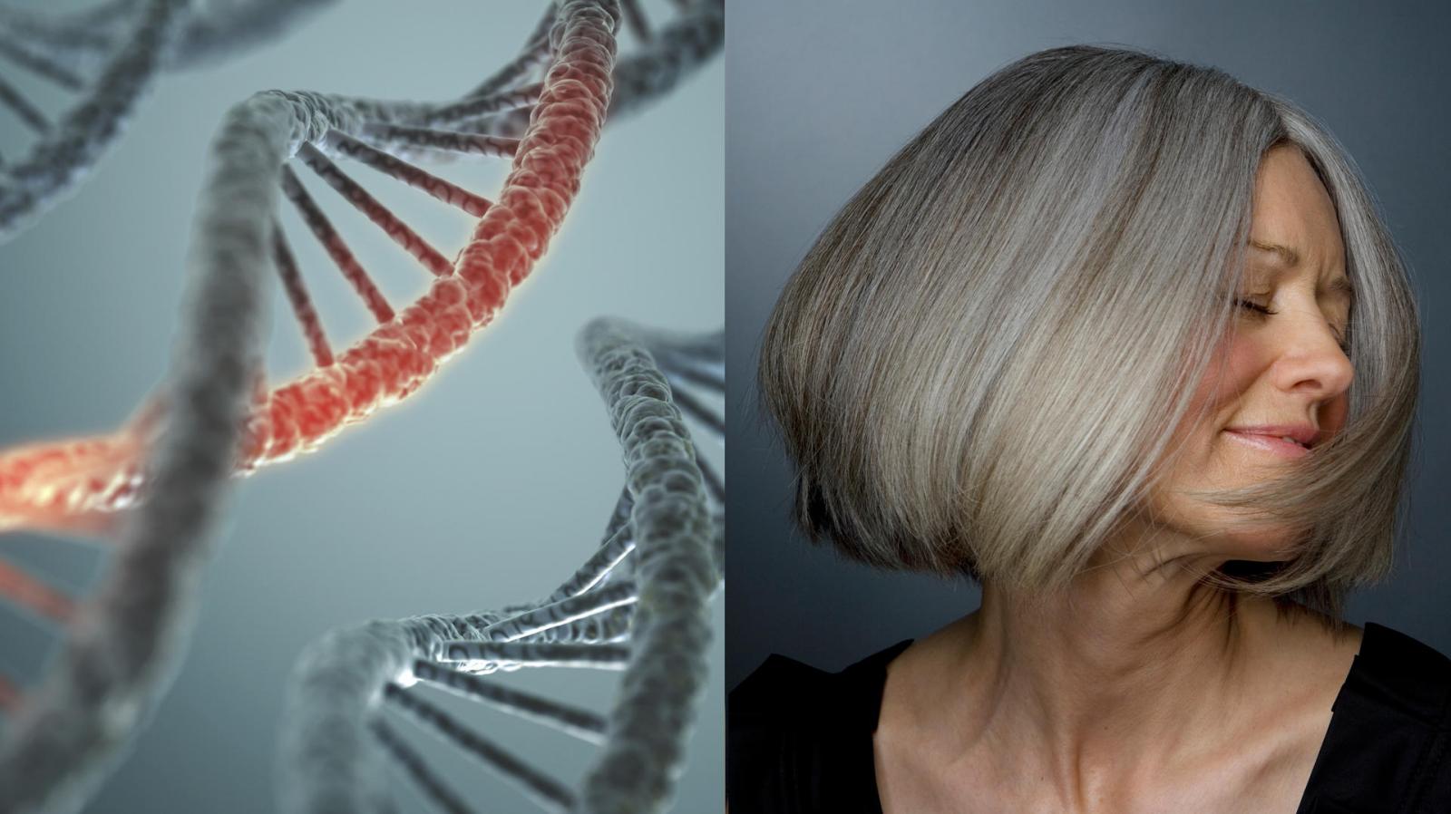 Gen IRF4 được cho là nguyên nhân tóc bạc sớm